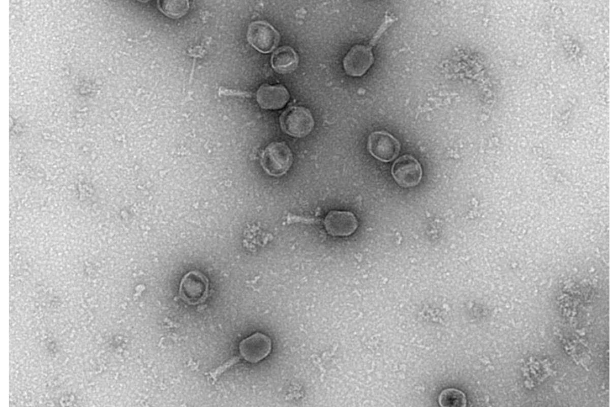 phage-T6-1 mouse kidnay negative staining